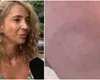 Cum se apără femeia acuzată că a mușcat un copil de șase ani pe plajă: „Fiind machiată, fix în ochi mi-a dat cu jetul puternic”