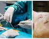 Primul ficat de porc transplantat unui pacient uman. Un experiment în premieră mondială
