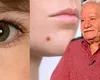 Mihai Voropchievici, despre semnificația semnelor din naștere: ”Apar la oamenii aleși”