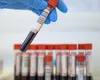 Analize gratuite pentru această categorie de români. Este nevoie doar de trimitere de la medicul de familie