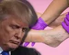 Donald Trump, diagnosticat cu insuficiență venoasă cronică. Ce presupune afecțiunea și cum se tratează