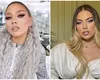 Jo a ajuns de urgență la spital și a fost operată. Cum se simte cântăreața: „Am patru incizii, nu e ușor”