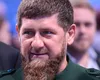 Ramzan Kadîrov se simte din ce în ce mai rău. Umblă cu punga de urină după el