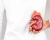 Ziua Mondială a Sindromului Hemolitic Uremic atipic. Boala poate deveni cronică și poate recidiva, fiecare minut contează!