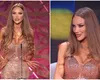 Bianca Drăgușanu, schimbată complet la față. Motivul pentru care are bărbia atât de ascuțită: „Multă lume e deranjată de aspectul meu”