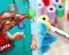 Alertă sanitară în România! 7 focare de hepatita A, depistate în mai multe localități din țară