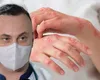 Medicul Adrian Marinescu trage un semnal de alarmă după confirmarea cazurilor de lepră din Cluj: „Oamenii, la un moment dat, făceau forme severe și ajungeau chiar la deces”