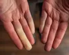 Boala semnalată de mâinile reci. Cum îți dai seama că nu e vorba despre o reacție la temperaturile scăzute