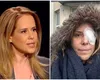 Mihaela Bilic a suferit o intervenție chirurgicală. În ce stare se află nutriționista: „Cum am început anul? Cu alți ochi. La propriu”