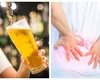 Ajută sau nu berea la eliminarea pietrelor de la rinichi? Medicii lămuresc acest mit