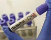 Primul caz de hantavirus, confirmat în România! Reacția Institutului Național de Sănătate Publică