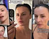 Influencerița Rux și Opulență, apariție șocantă pe stradă după un tratament facial de ultimă generație: „Arăt superb și așa. Am trăsături roiale”. Cât costă procedura