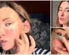 Iulia Albu recunoaște că a apelat la medicul estetician: „Nu vreau să arăt altfel, nu vreau buze mai mari, nici trăsături schimbate”