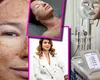 EXCLUSIV Spongilla, unul dintre cele mai căutate tratamente de înfrumusețare. Un specialist explică de ce este atât de apreciat și cât costă: „Îmbunătățește textura pielii”