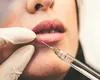 O femeie de 48 de ani din Constanța riscă să ajungă după gratii după ce a făcut operații estetice fără a fi medic
