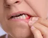 Sângerarea gingiilor: semn banal sau primul indiciu al unei probleme parodontale?