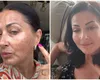 Cu ce afecțiune se confruntă Gabriela Cristea. Imaginile care i-au îngrijorat pe fani: „Mi-am făcut, în sfârșit, un tratament”