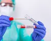 EXCLUSIV | Haos la testarea COVID din Bucureşti. Doar două spitale pot face teste, deşi DSP a prezentat o listă cu 28 de unităţi