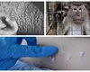 Principalele surse ale infectărilor cu variola maimuţei: o petrecere LGBT în Spania şi un festival cu zeci de mii de oameni în Belgia