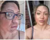 Un truc viral pe TikTok i-a ars fața unei femei. Victima trage un semnal de alarm: „Un moment terifiant, am fost într-o agonie absolută”