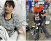 Fiul lui Eduard Novak, desfigurat în urma unui accident rutier. În ce stare se află băiatul acum