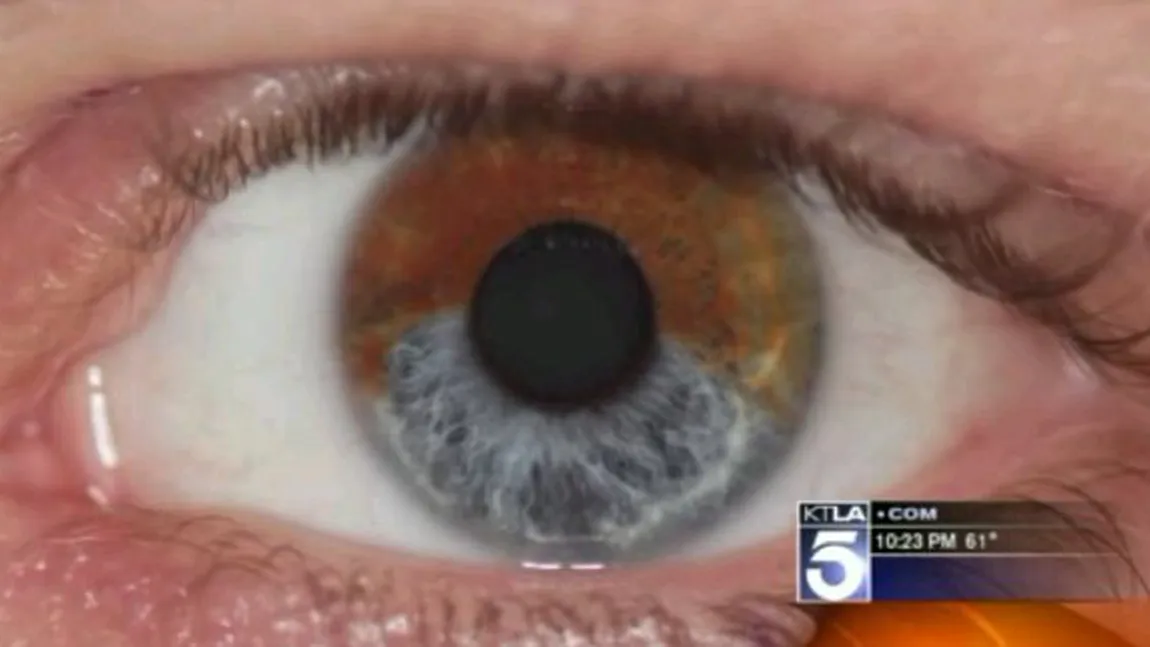 Cum poţi să-ţi schimbi culoarea ochilor fără lentile de contact VIDEO