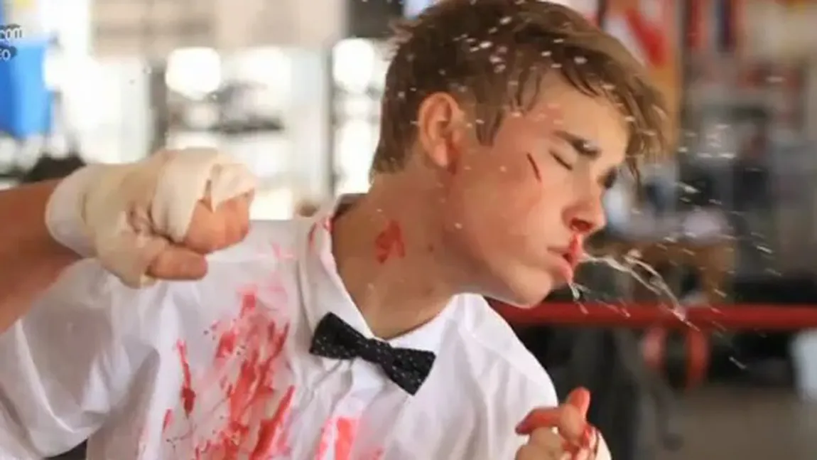 Imagini şocante cu Justin Bieber plin de sânge FOTO&VIDEO