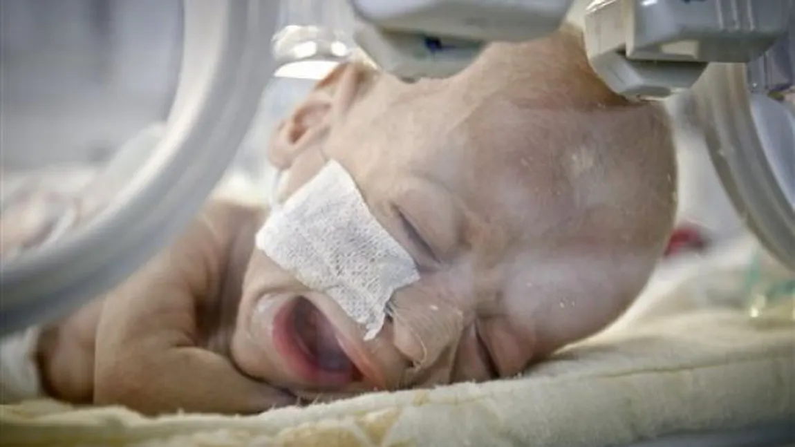 Bebeluşul român născut fără intestine, operat de medicii americani