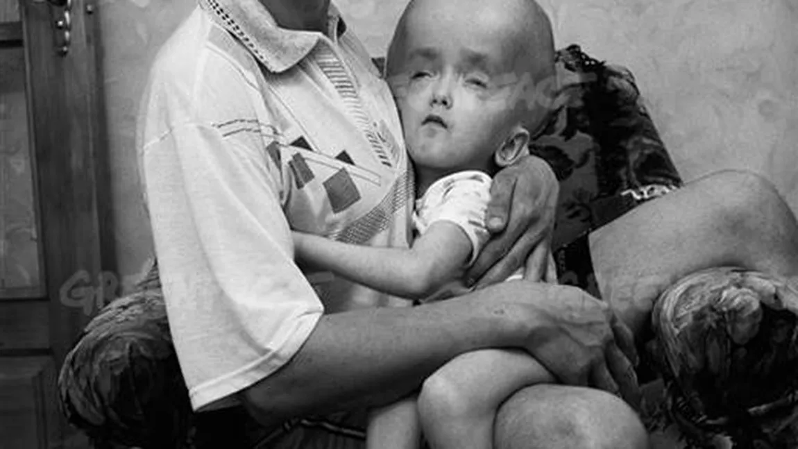 Greenpeace: Expoziţie fotografică cu victimele de la Cernobîl, la Muzeul Bucureştiului FOTO