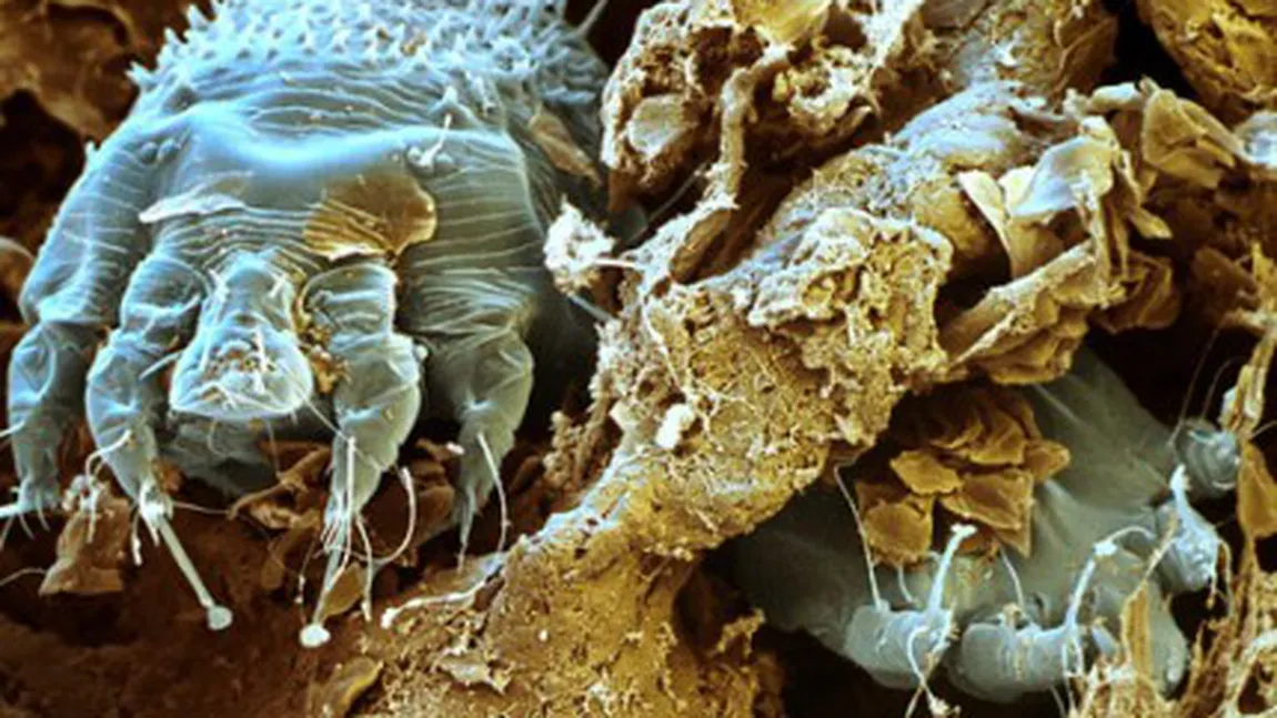 Înţepăturile de insecte care îţi pot strica vacanţa