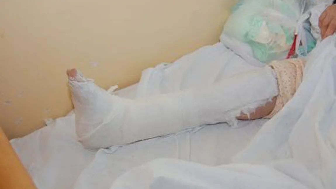 A început liceul cu stângul. O elevă a ajuns la spital cu piciorul rupt, după ce banca a cedat