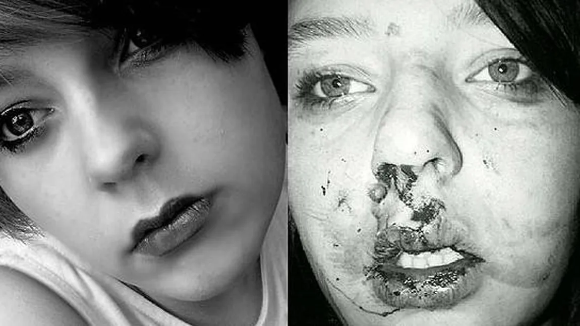 IMPRESIONANT: O adolescentă a devenit MODEL după ce a fost mutilată de nouă colegi