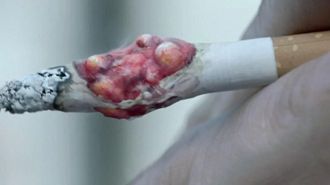 Vrei să renunţi la ţigări? Vezi cea mai SCÂRBOASĂ reclamă împotriva fumatului VIDEO