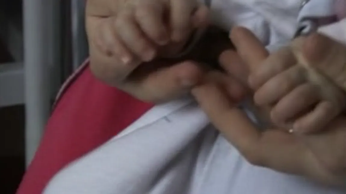 O fetiţă s-a născut cu şase degete la o mână VIDEO