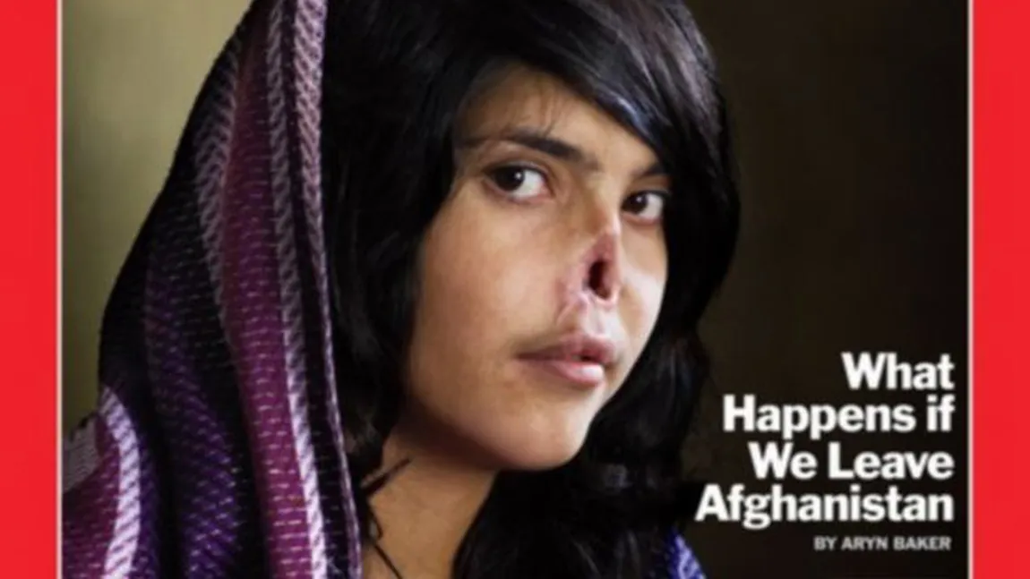 Aesha, fata afgană cu nasul tăiat, şi-a revenit spectaculos. Vezi cum arată! GALERIE FOTO