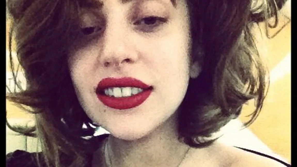 Lady Gaga a fost operată la şold: M-am gândit la toată durerea şi perseverenţa voastră