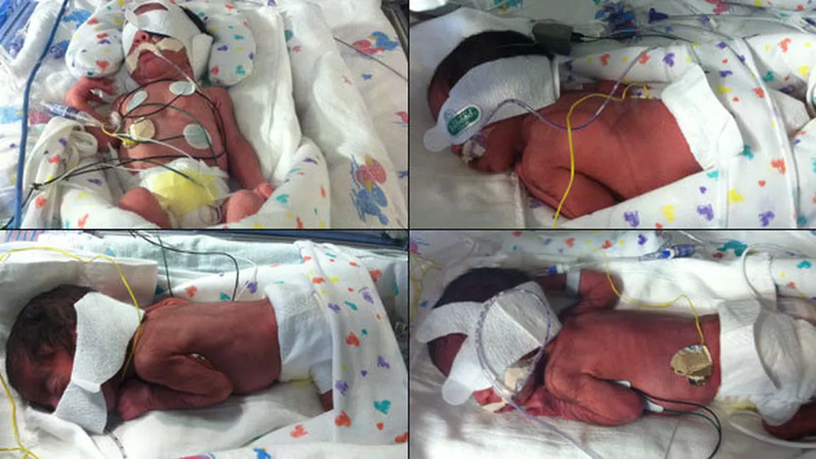 Fenomen extrem de rar: O femeie din Texas a născut două perechi de gemeni identici FOTO
