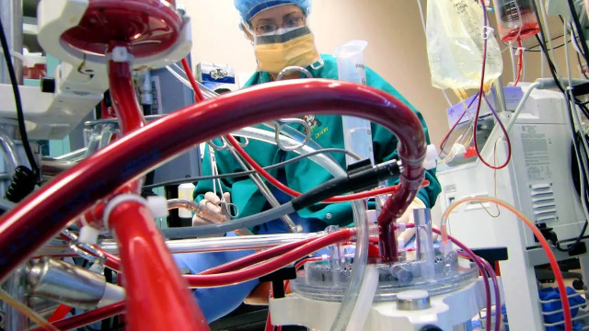 PREMIERĂ MEDICALĂ în România: Plămân artificial, folosit la un pacient cu insuficienţă respiratorie