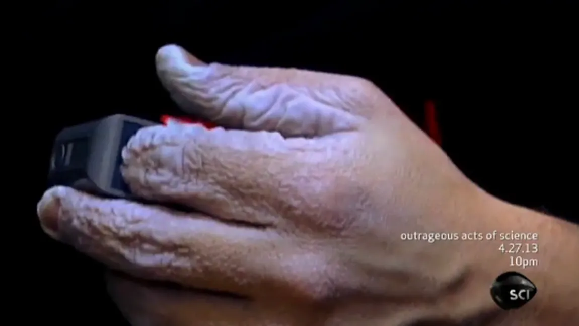 Experiment periculos: Cum arată mâinile omului care a stat 10 zile sub apă VIDEO