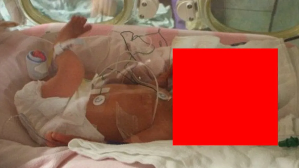 Şocant: Copilul cu cel mai BIZAR CAP pe care doctorii l-au văzut vreodată FOTO