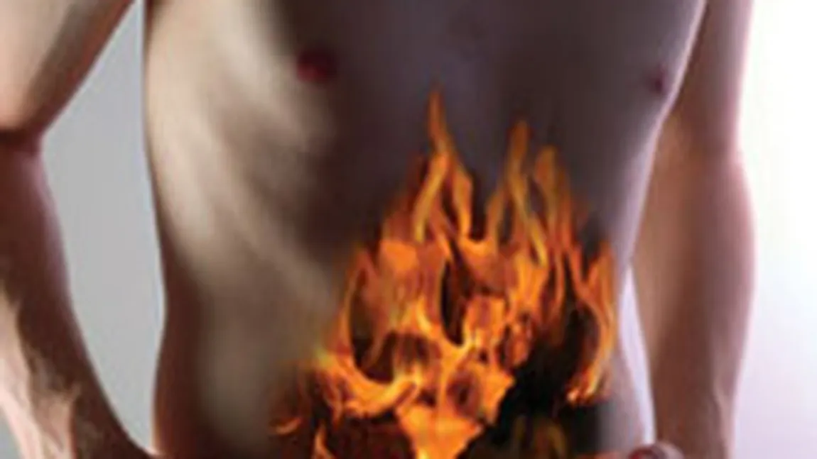 Arsuri la stomac: Mituri dărâmate despre arsurile gastrice