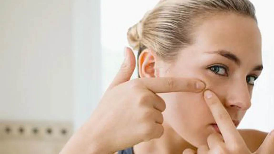 Ce să faci ca să scapi PERMANENT de acnee