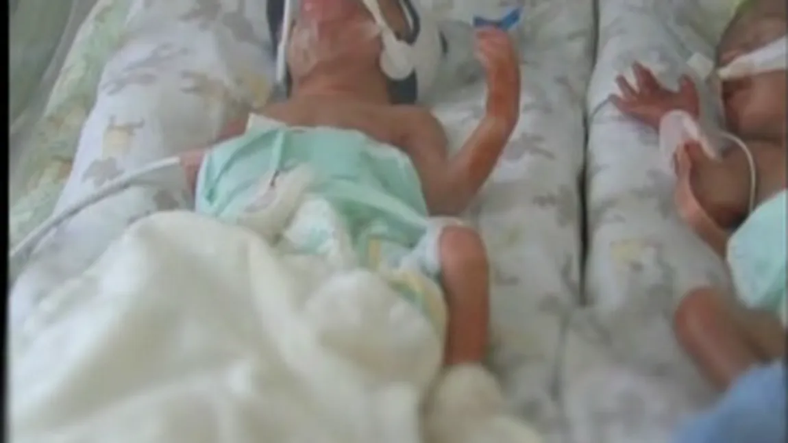 O tânără a născut PATRU bebeluşi la Maternintatea Braşov VIDEO