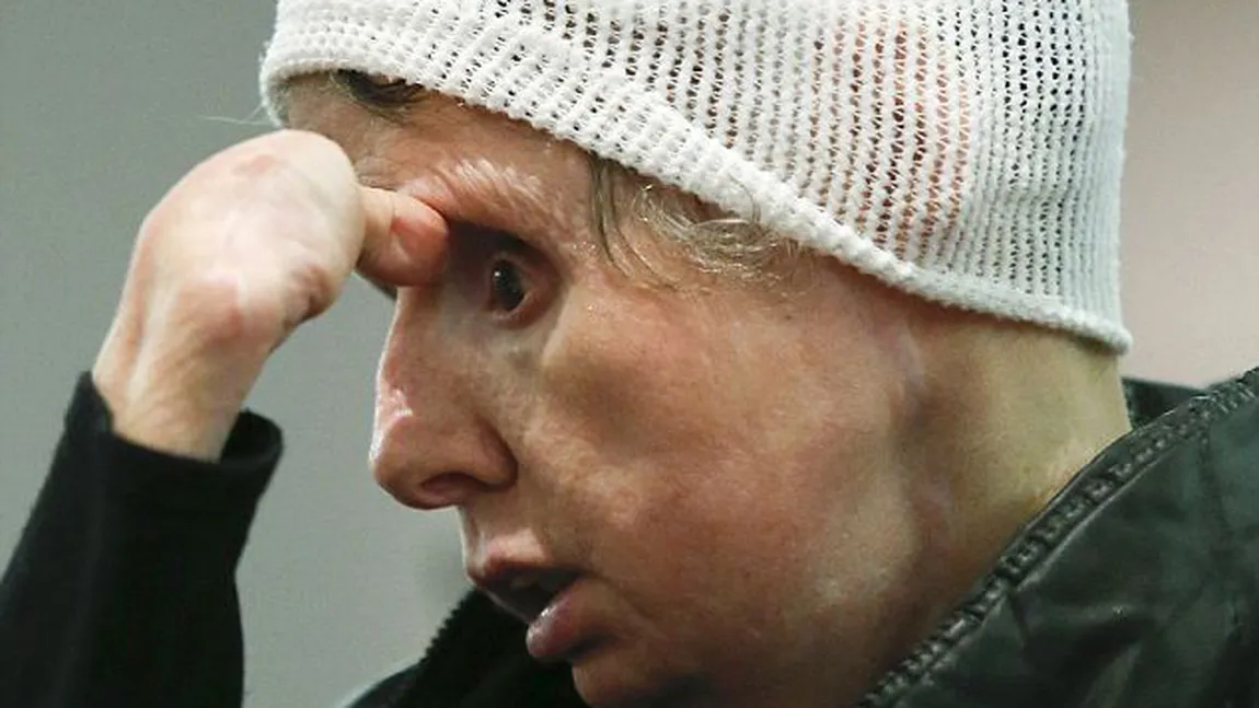 Femeia MUTILATĂ de un cimpanzeu cere daune de 150 de milioane de dolari FOTO&VIDEO
