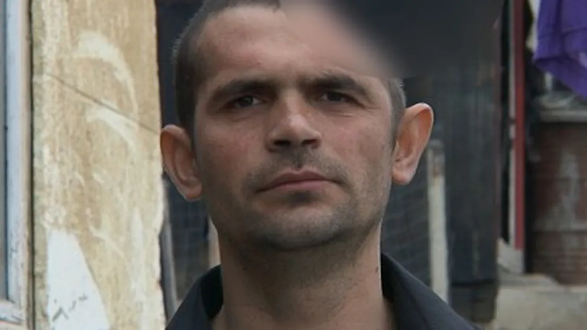 Românul care trăieşte cu doar jumătate de craniu. FOTO şi VIDEO