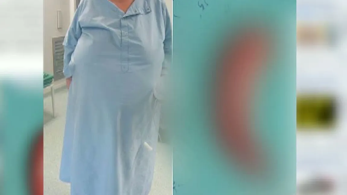 Medici acuzaţi de înşelăciune. O pacientă s-a trezit cu o notă de plată uriaşă după o operaţie VIDEO