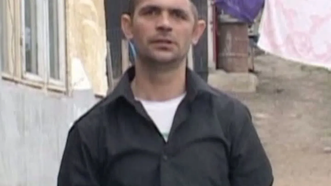 Românul care trăieşte cu o JUMĂTATE DE CAP i-a sensibilizat pe britanici. Povestea sa a ajuns în presa engleză