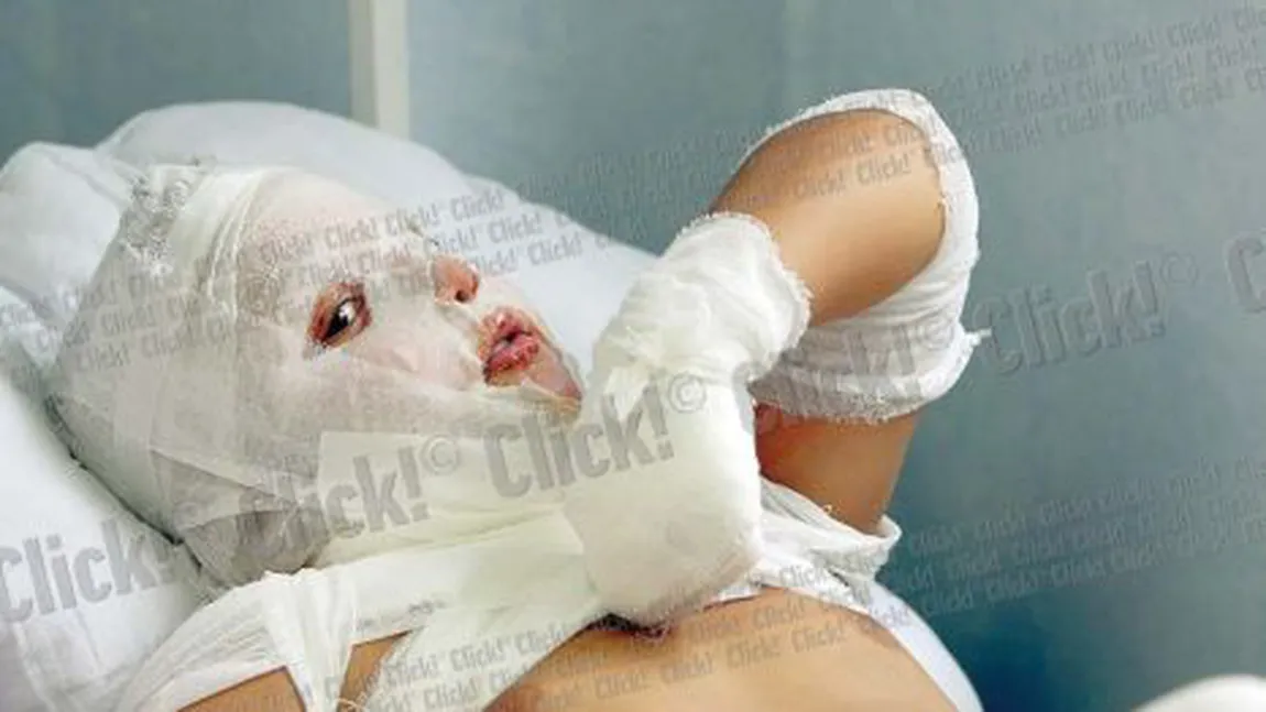 Nu Smiley şi Bartoş sunt de vină în cazul copilului electrocutat: 