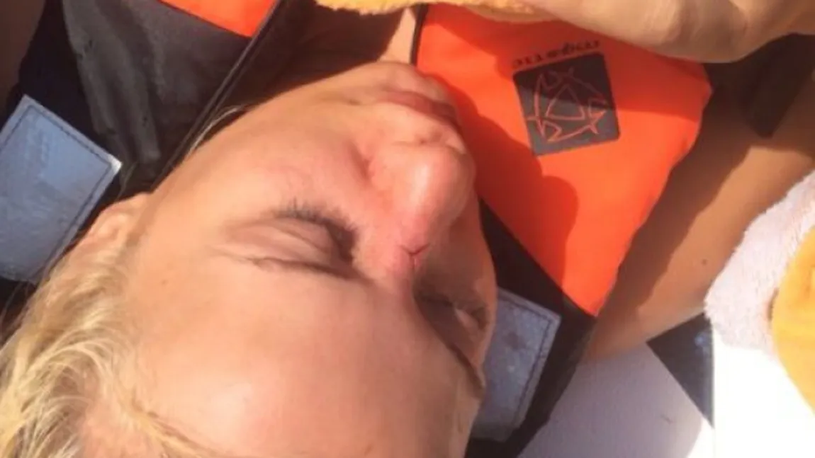 Simona Traşcă, la un pas de o TRAGEDIE. Blonda s-a lovit de o şalupă şi şi-a spart nasul VIDEO