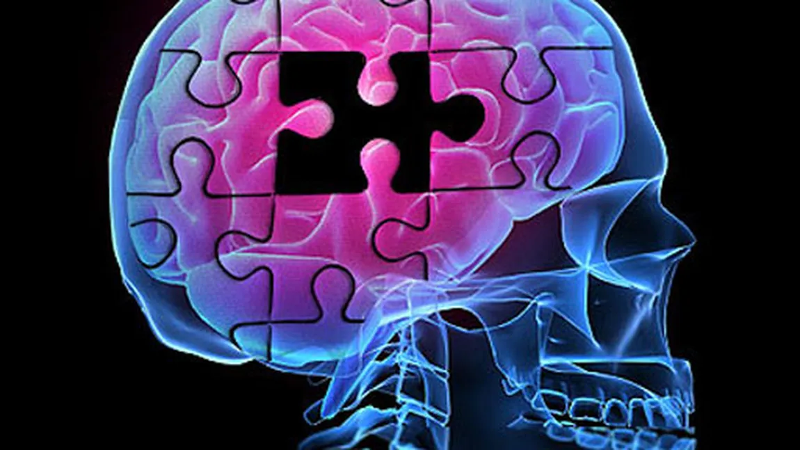 Semnele care îţi arată că poţi suferi de Alzheimer